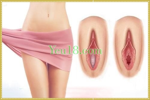 Màng trinh bình thường và đã rách