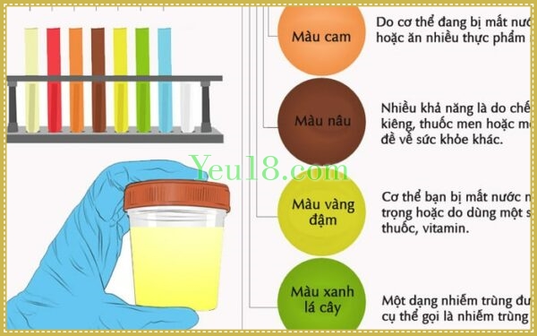 Uống nước tiểu của bạn tình không tốt và không nên thực hiện