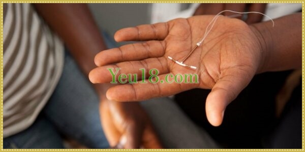 Không nên tự tháo vòng tránh thai tại nhà - Hãy đi đến cơ sở y tế đề thực hiện